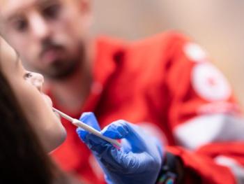 tampone per l'hiv