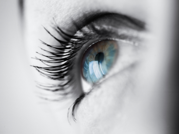 glaucoma