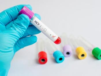Screening Epatite C (HCV)